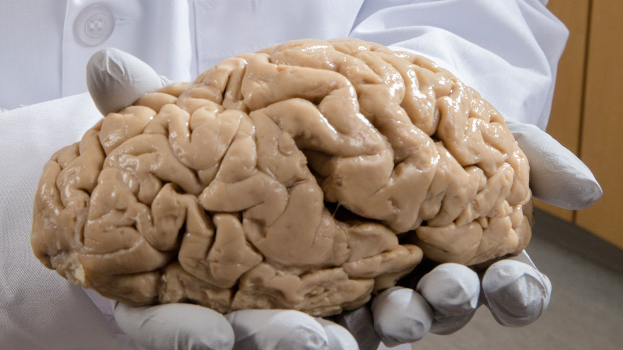 Ca 1214NID Brain Bank online