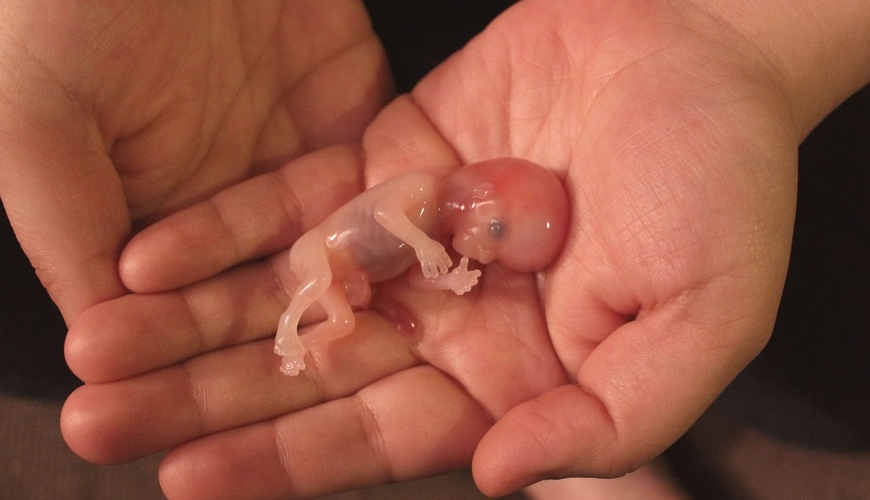 Aborty